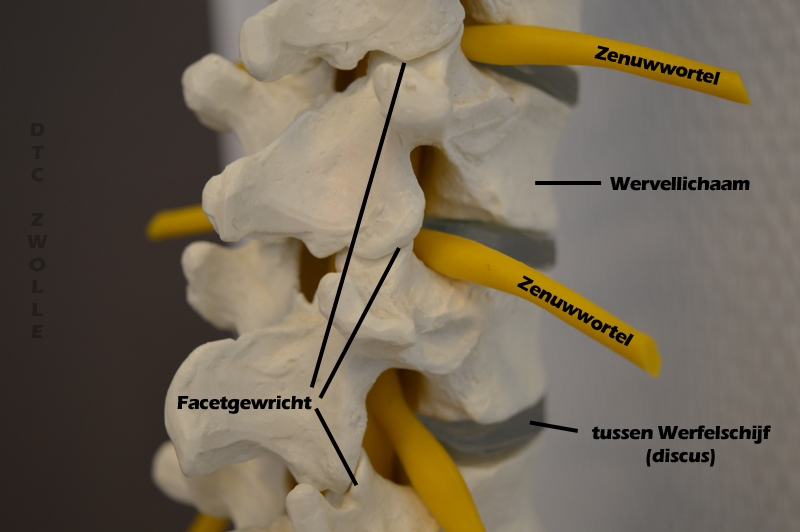 rugklachten DSC 0819