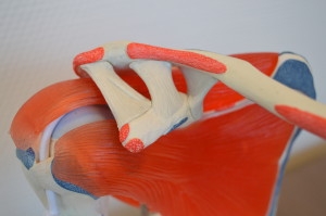 rugklachten schouder